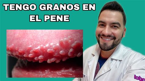 granitos en el oene|Enfermedades piel pene